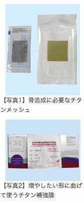 確実な骨造成をする材料